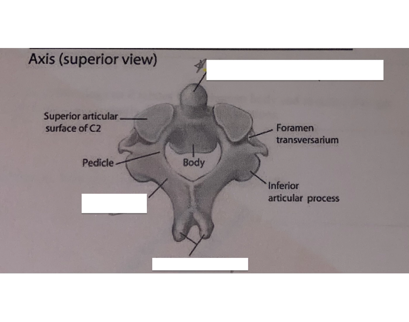 Axis Superior View Label — Printable Worksheet