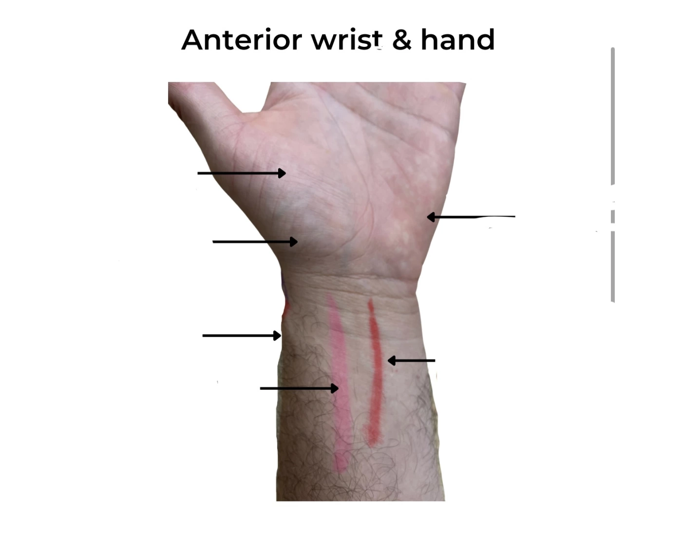 Anterior Wrist And Hand Quiz anterior-wrist-and-hand-quiz