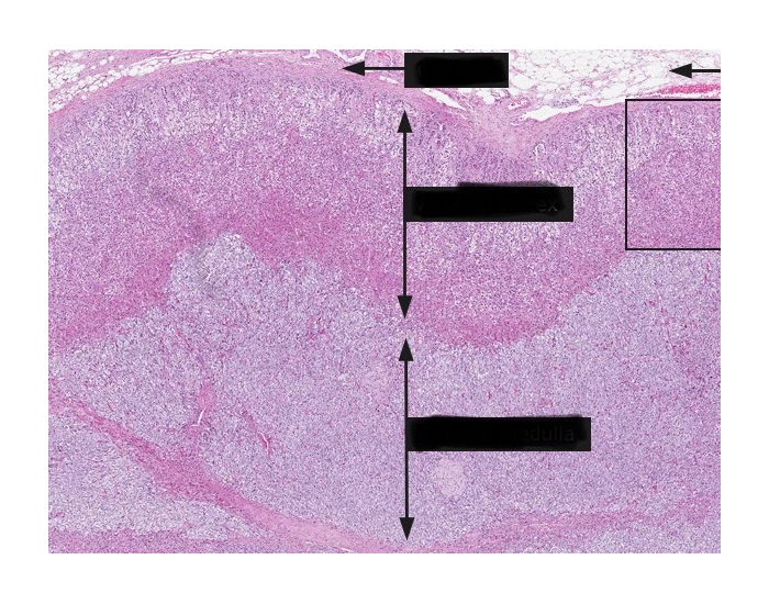 Adrenal gland Quiz