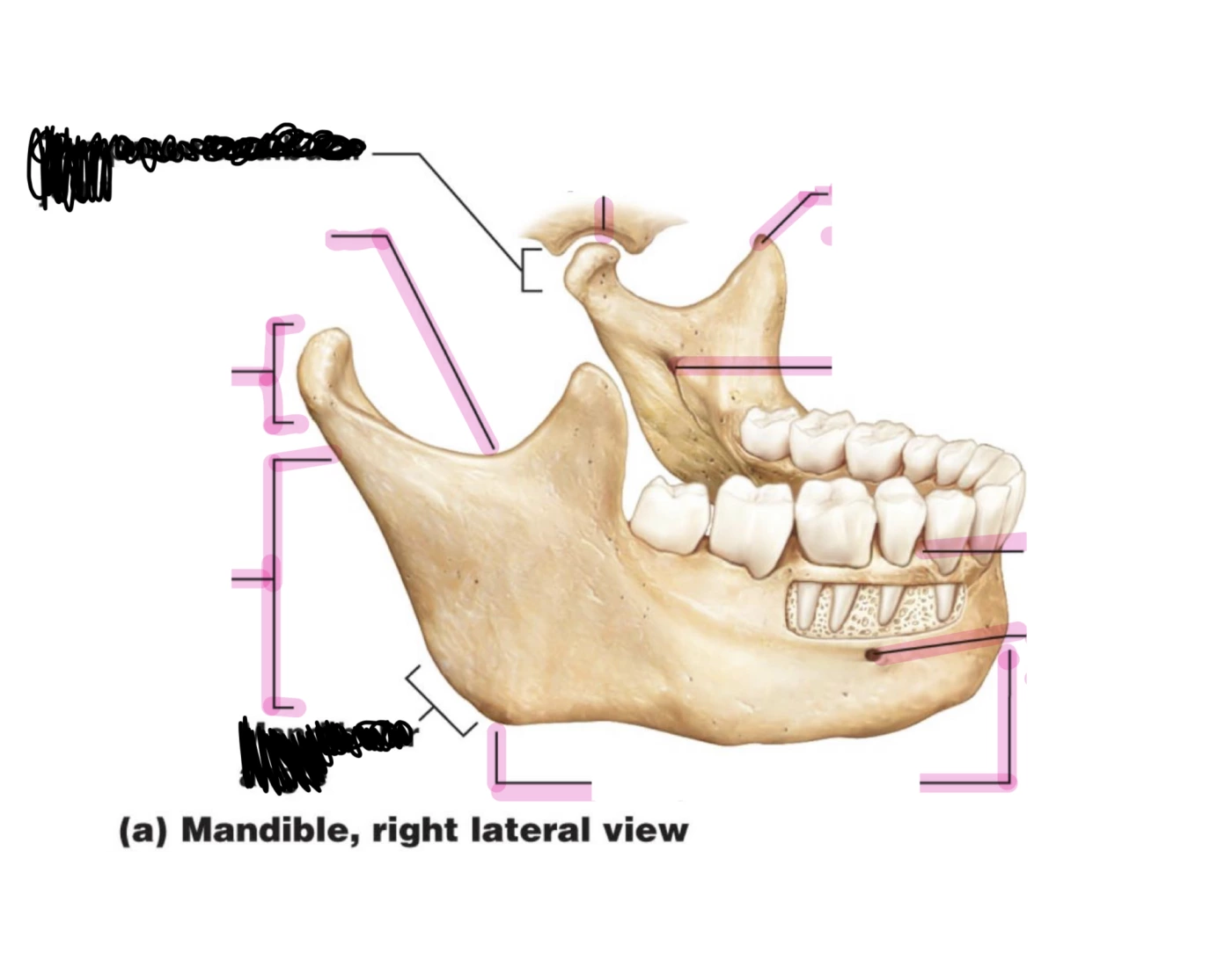 mandible, right lateral view Quiz