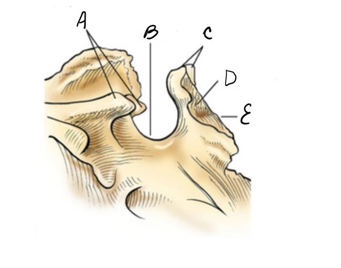 Sella Turcica of Sphenoid Bone Quiz