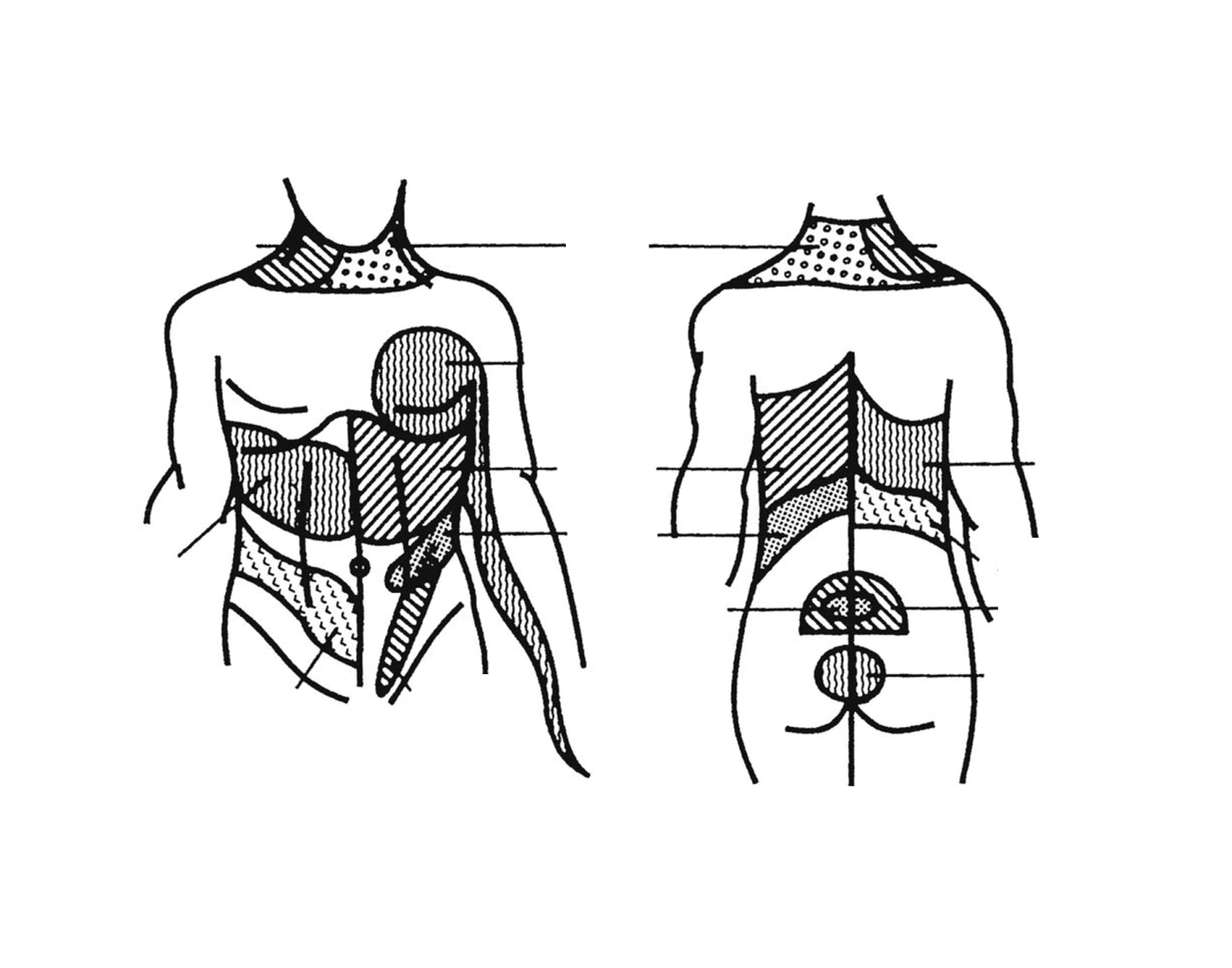 Referred Pain Diagram Quiz referred-pain-diagram-quiz
