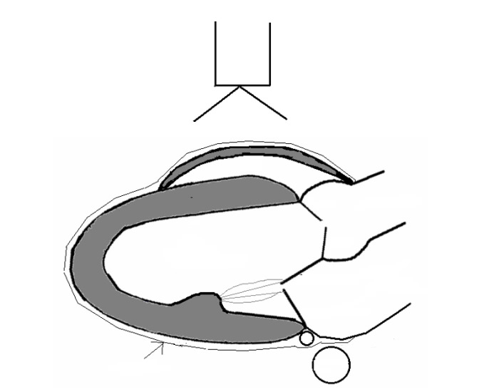 PLAX View - Cardiac Ultrasound Quiz