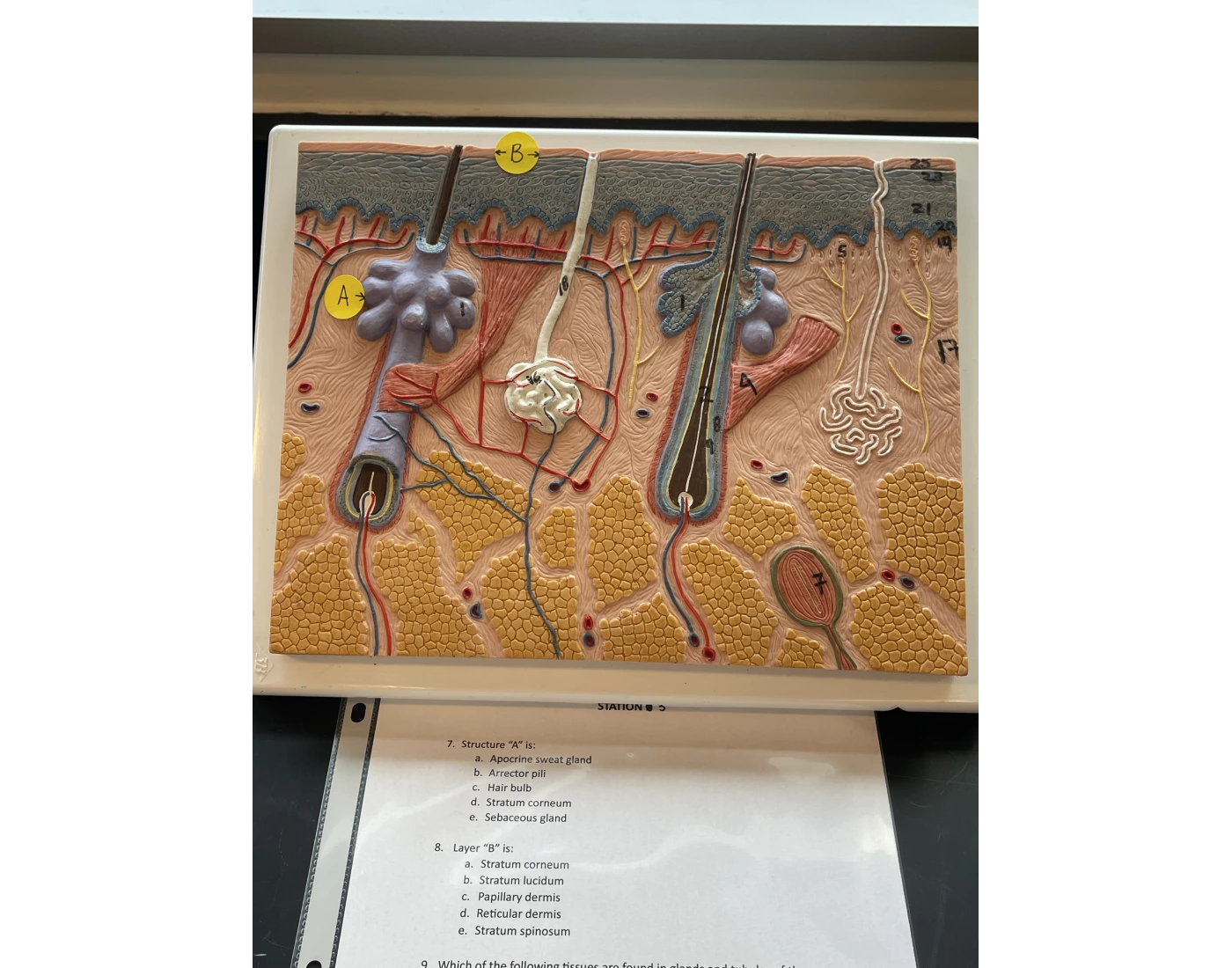 Skin Model A&P 1 Lab Quiz