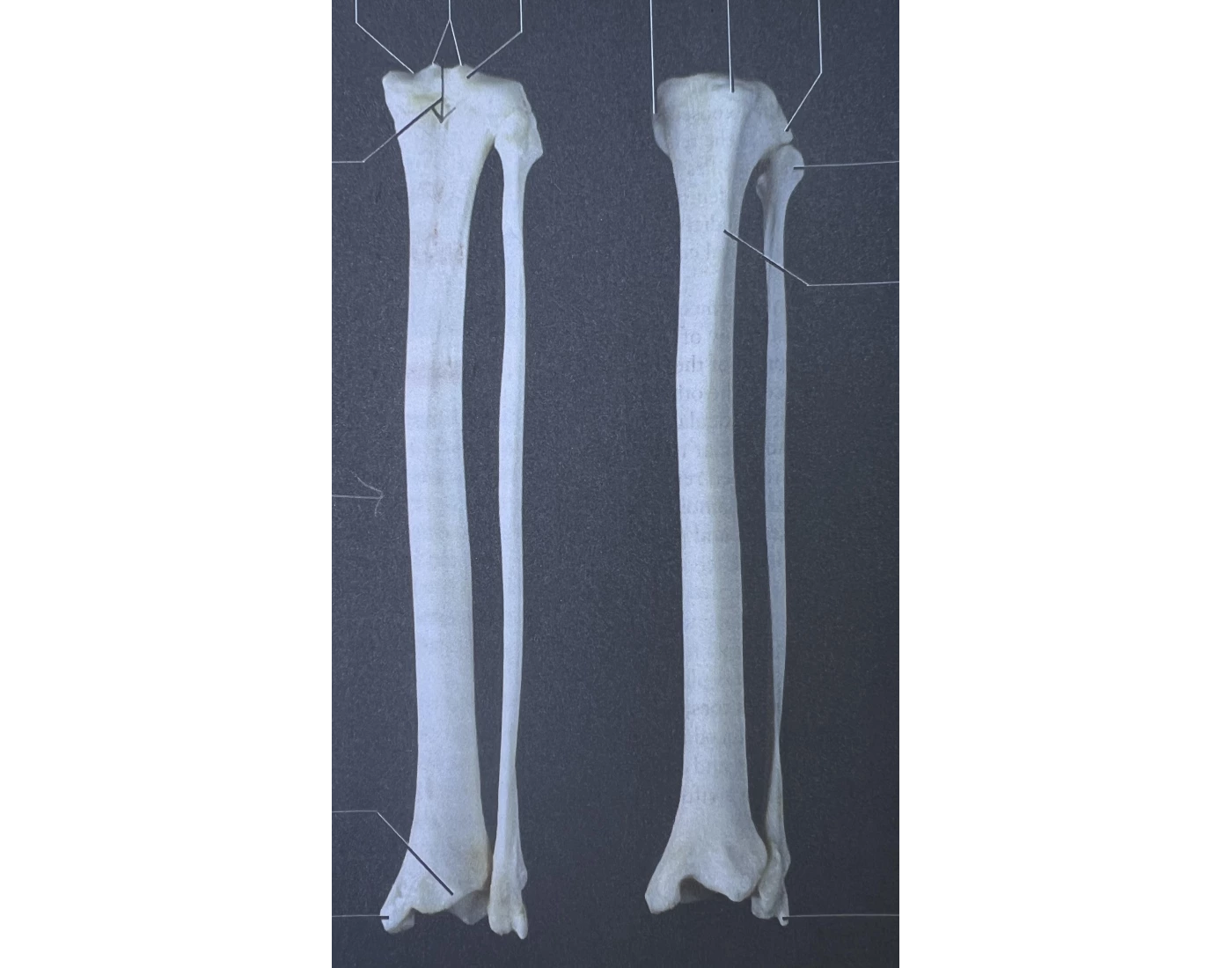 Tibia/Fibula Cat Quiz