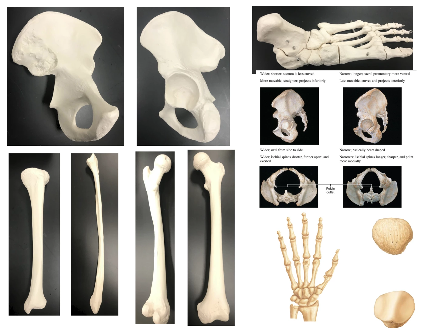 Bio 210 Appendicular skeleton Part 2 Quiz Biology Diagrams