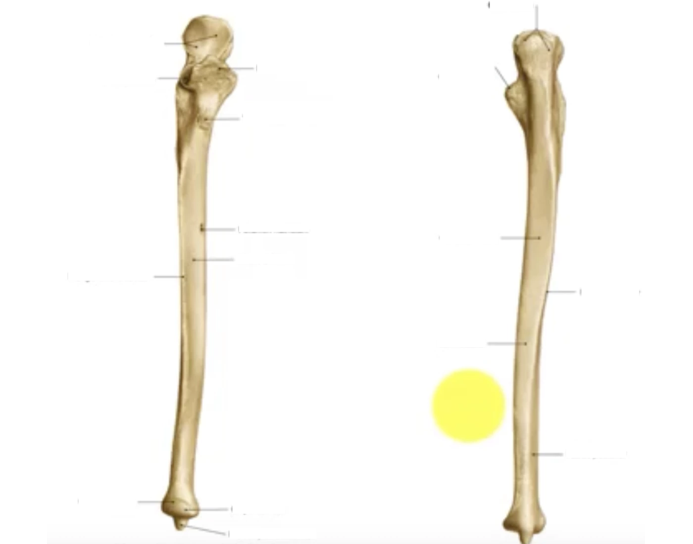Os Rulna Os Ulna Quiz