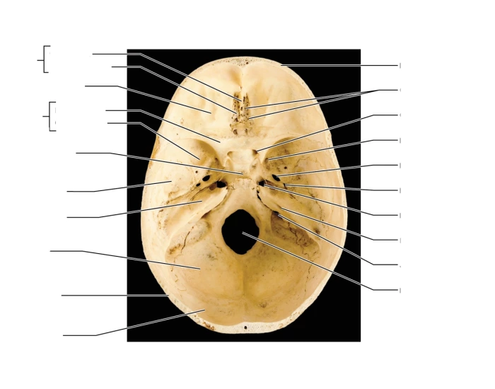 Label the superior view of the skull — Printable Worksheet