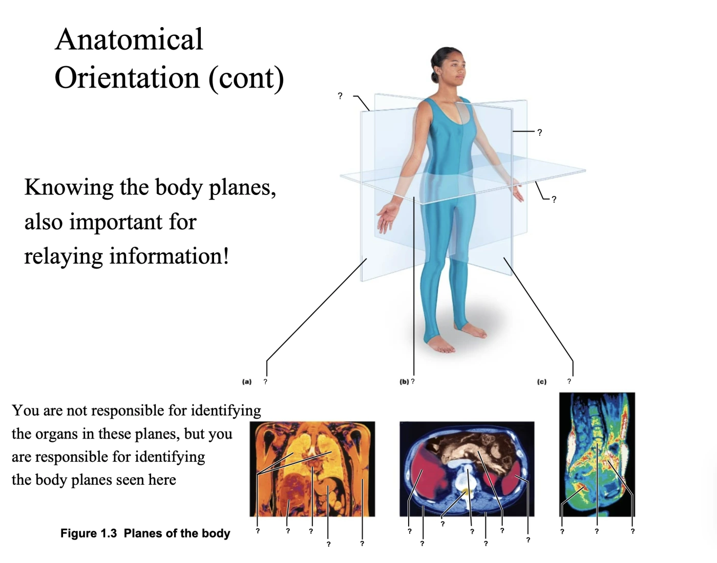 Anatomical Orientation The Planes Quiz