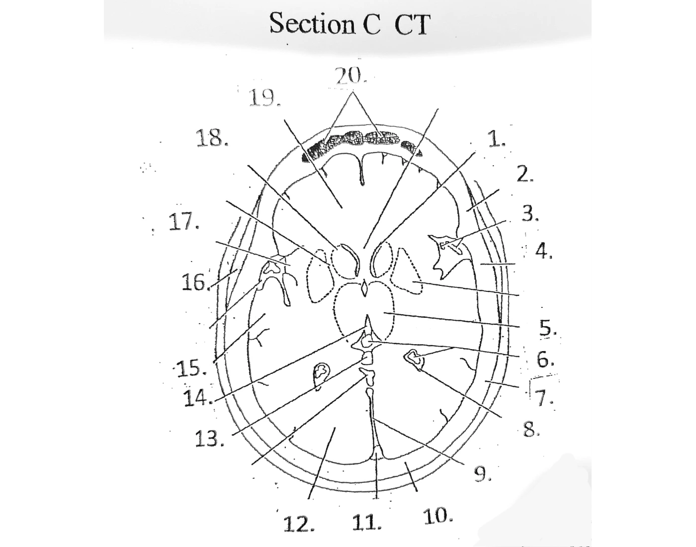 Sectional Anatomy brain section C Quiz