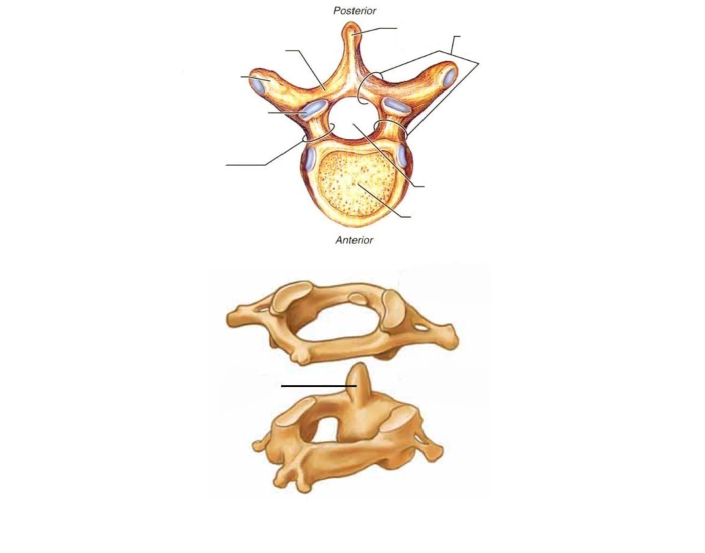 Two Separate Views Atlas / Axis / Vertebral Body — Printable Worksheet