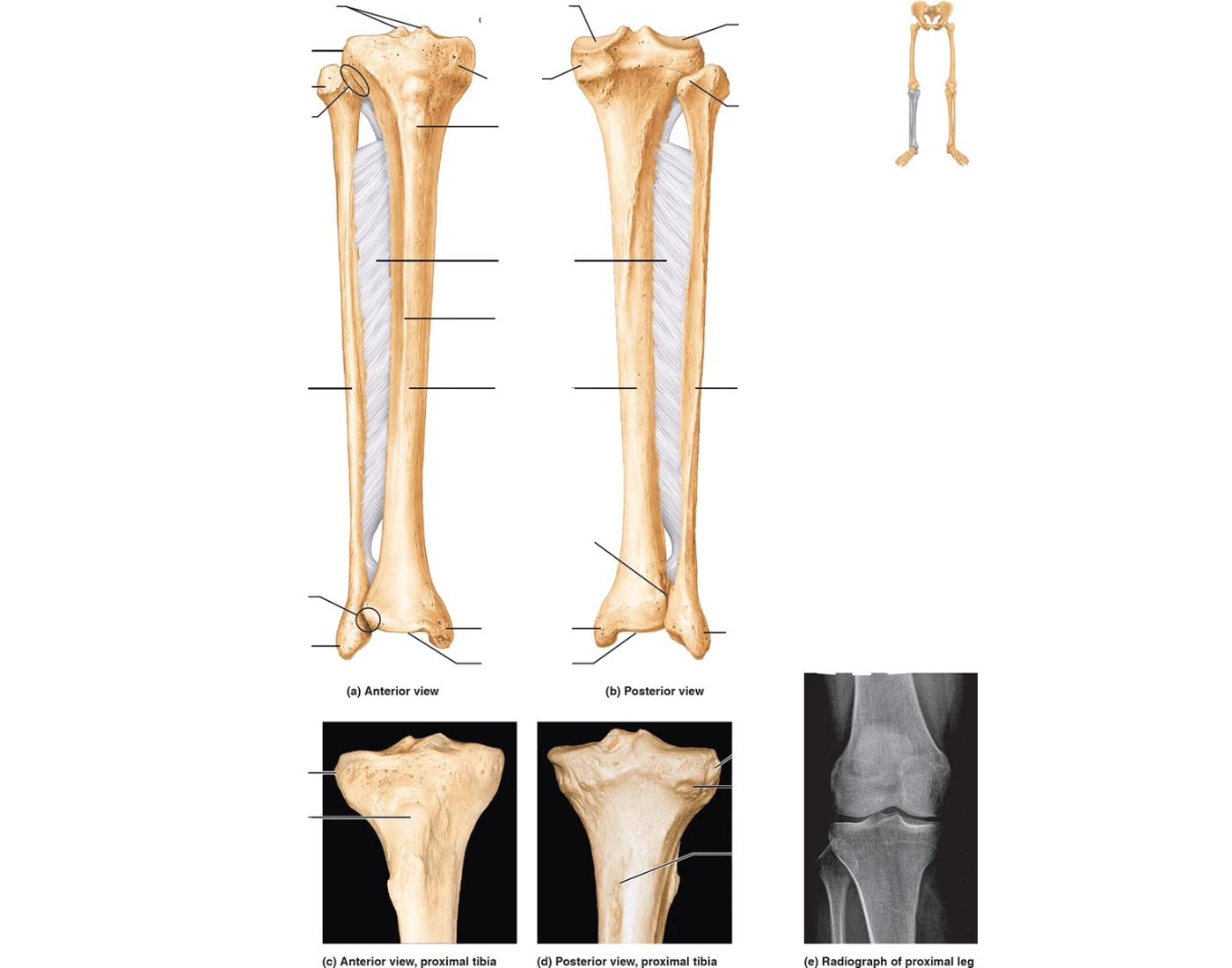 Label tibia Quiz
