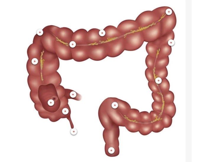 Printable Colon Anatomy of Colon — Printable Worksheet