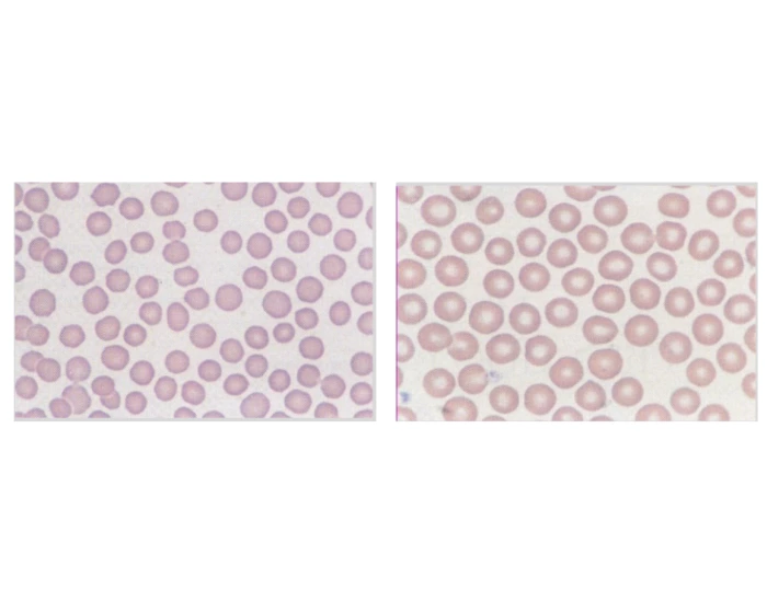 Animal Rbcs Canine/Feline RBC's Quiz