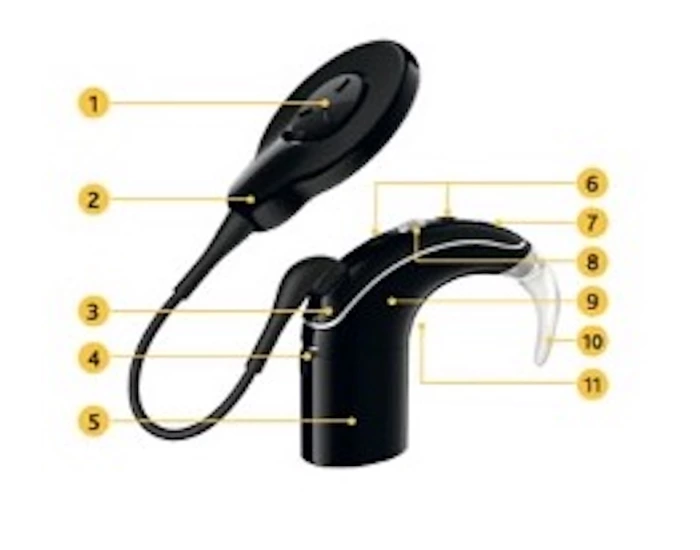 nucleus 7 sound processor cochlear implant Quiz