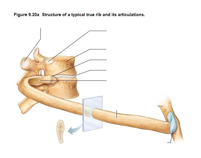 Structural Rib Fillet Structure of Typical True Rib (lateral? view) Quiz