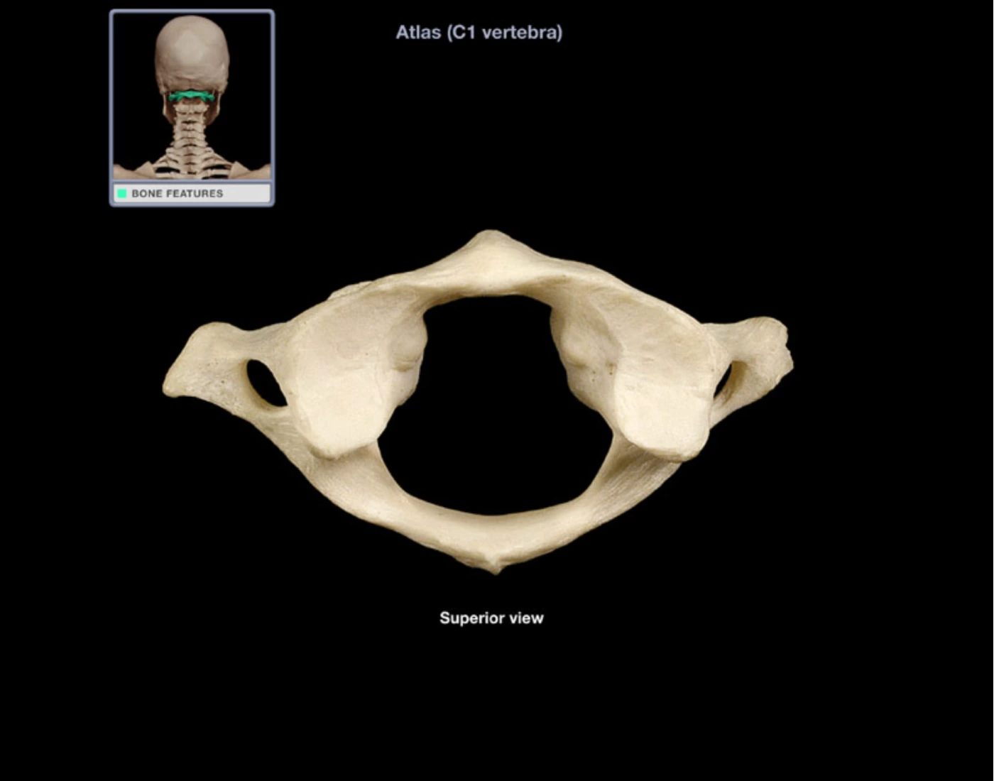 Axial Skeleton Part 9: Atlas Quiz