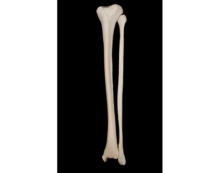 Label the Tibia + Fibula Quiz