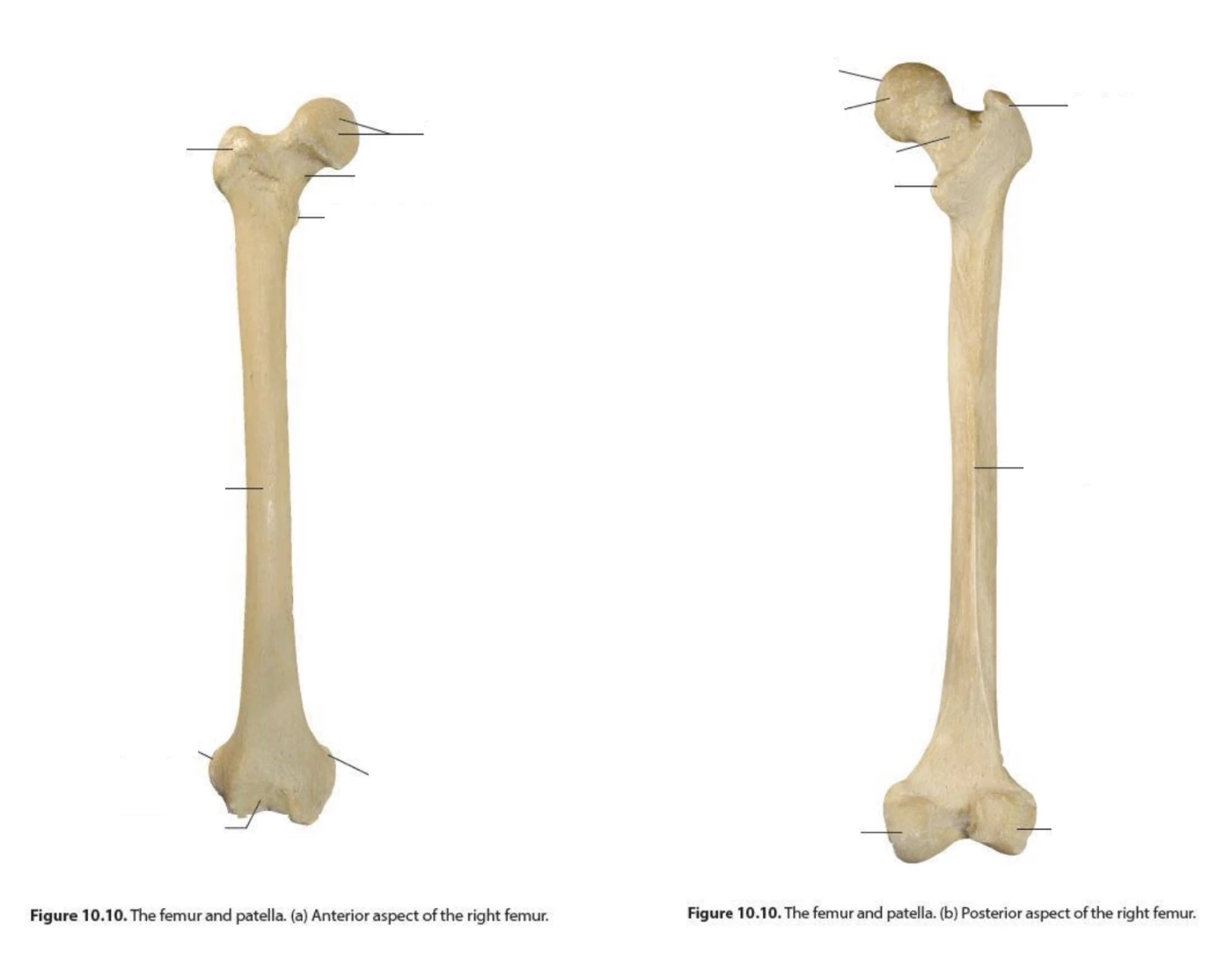 Fêmur - Anatomia Quiz