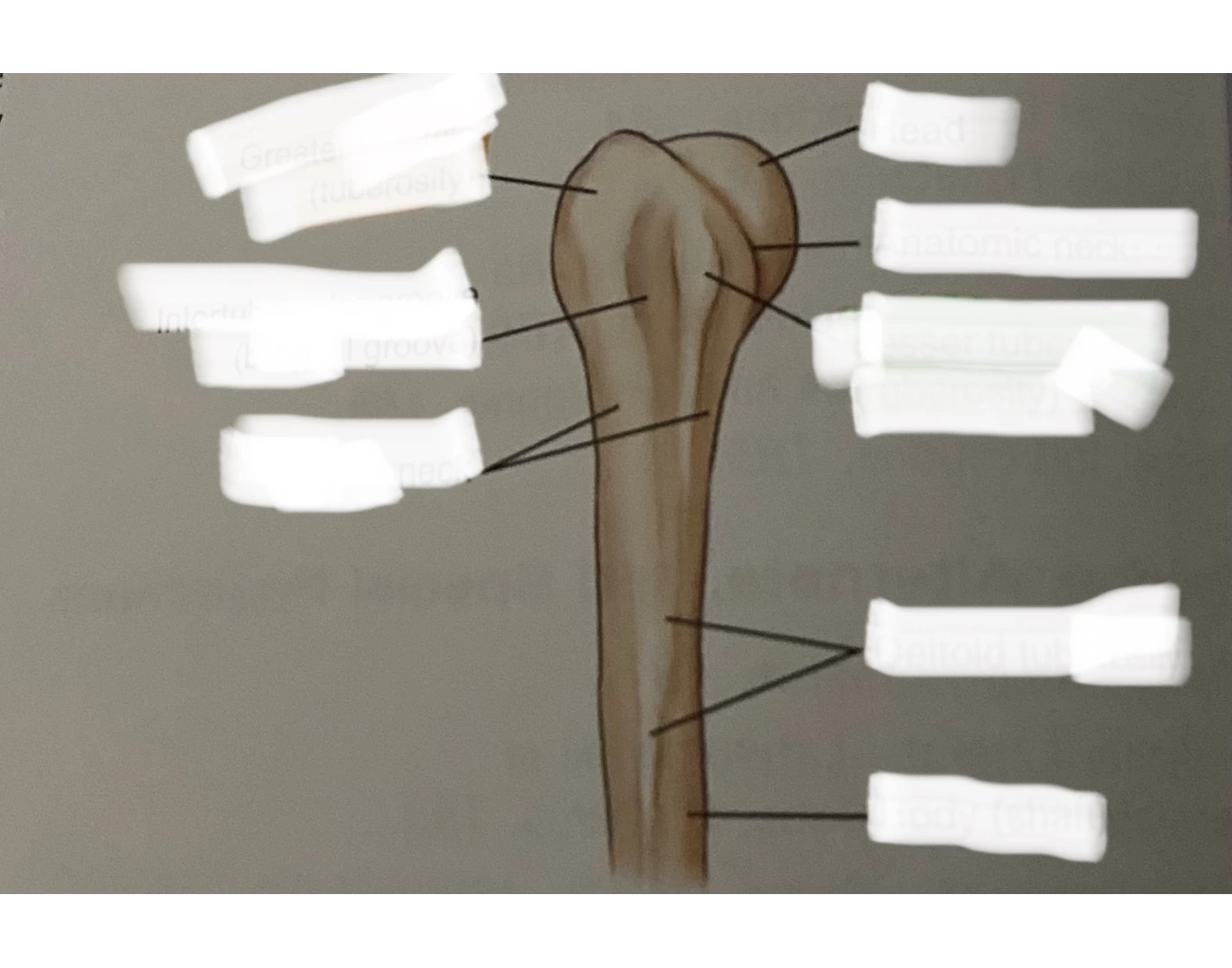 Frontal view of proximal humerus-neutral rotation Quiz