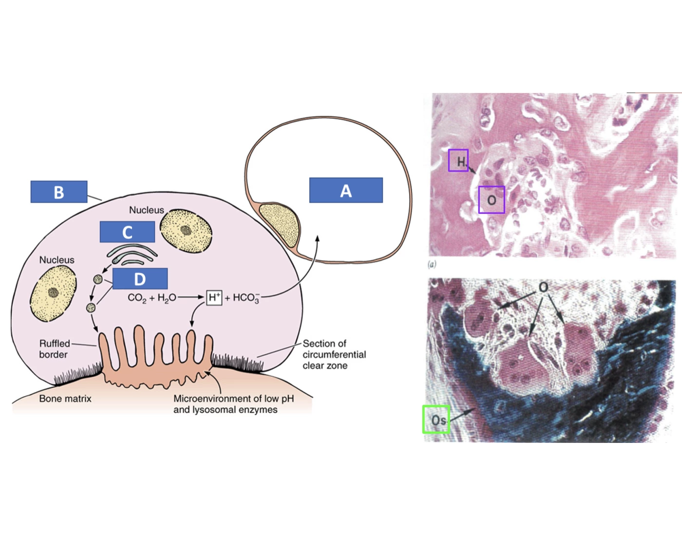 Bone remodeling Quiz
