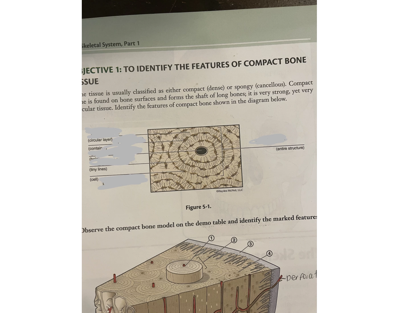 Bone Tissue Quiz