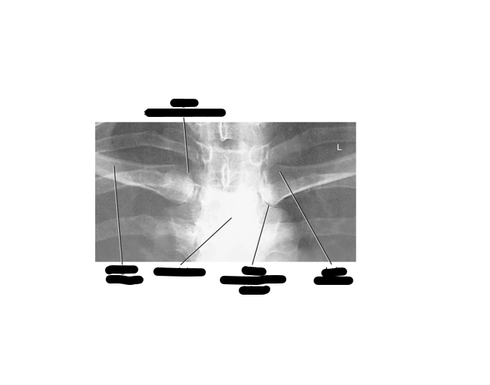 Sc Joint Testing PA Bilateral SC joints Quiz