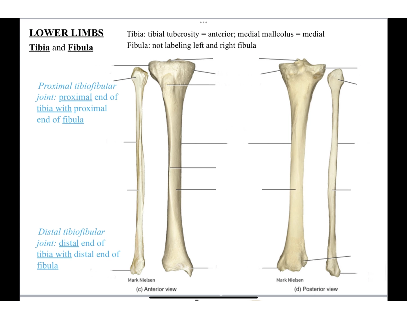 Trivia Tibia Lower Limbs - Tibia and Fibula Quiz