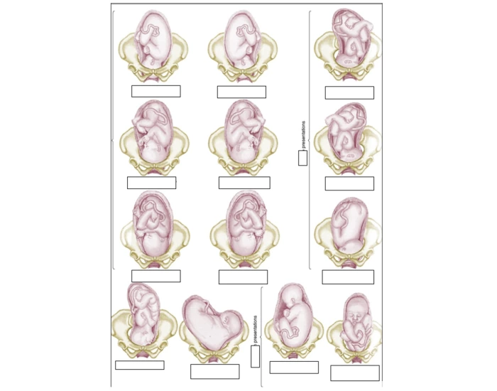 fetal presentation quiz