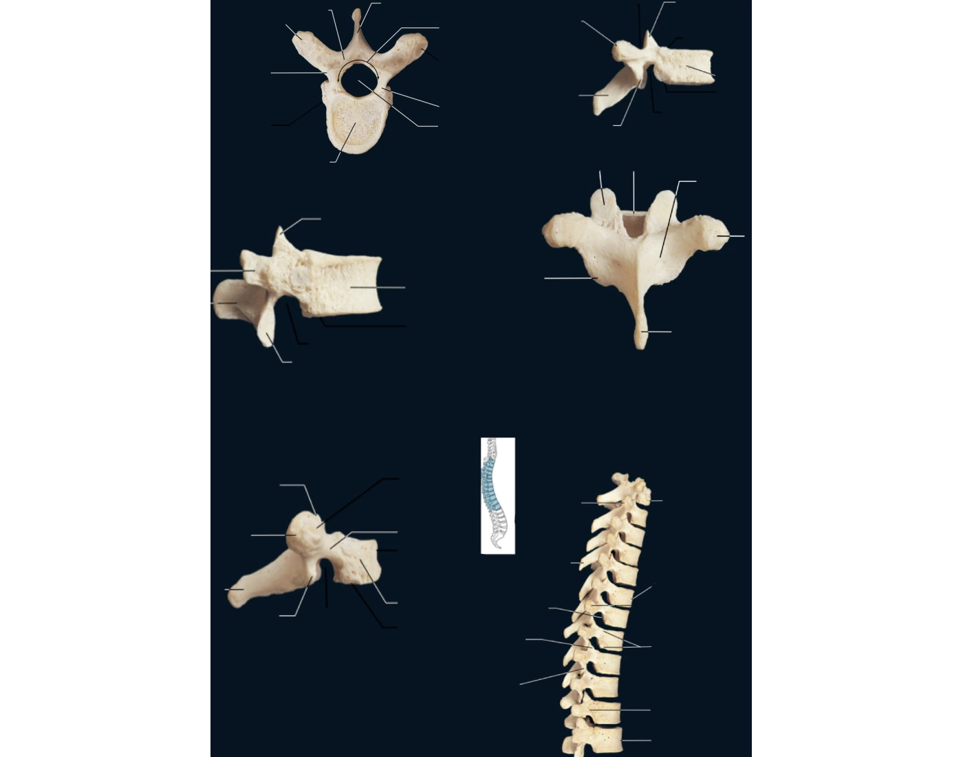 Thoracic Vertebrae T1-T12 Quiz