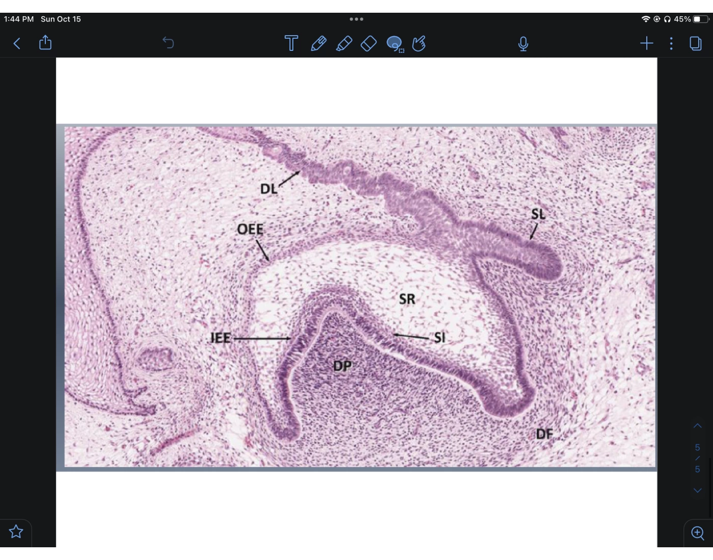 Cap stage of tooth development — Printable Worksheet