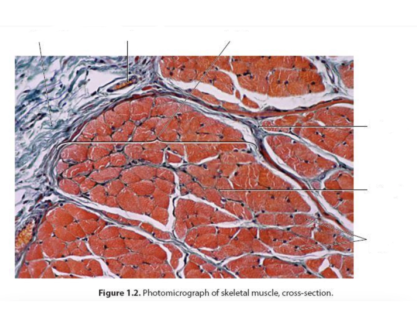Muscle Cross Section Model skeletal muscle in cross-section Quiz