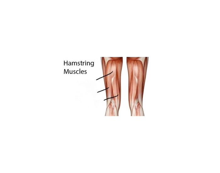 label the 3 hamstring muscles Quiz