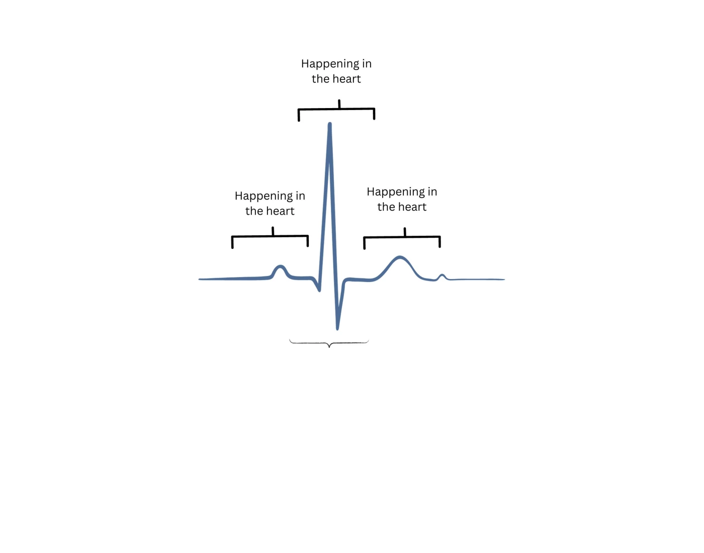 ECG EKG Worksheet Quiz ECG EKG Worksheet Quiz
