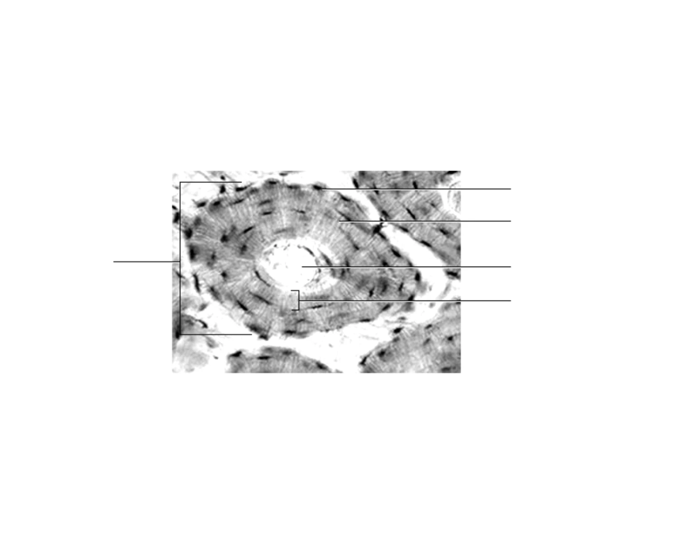 Histology of compact bone Quiz