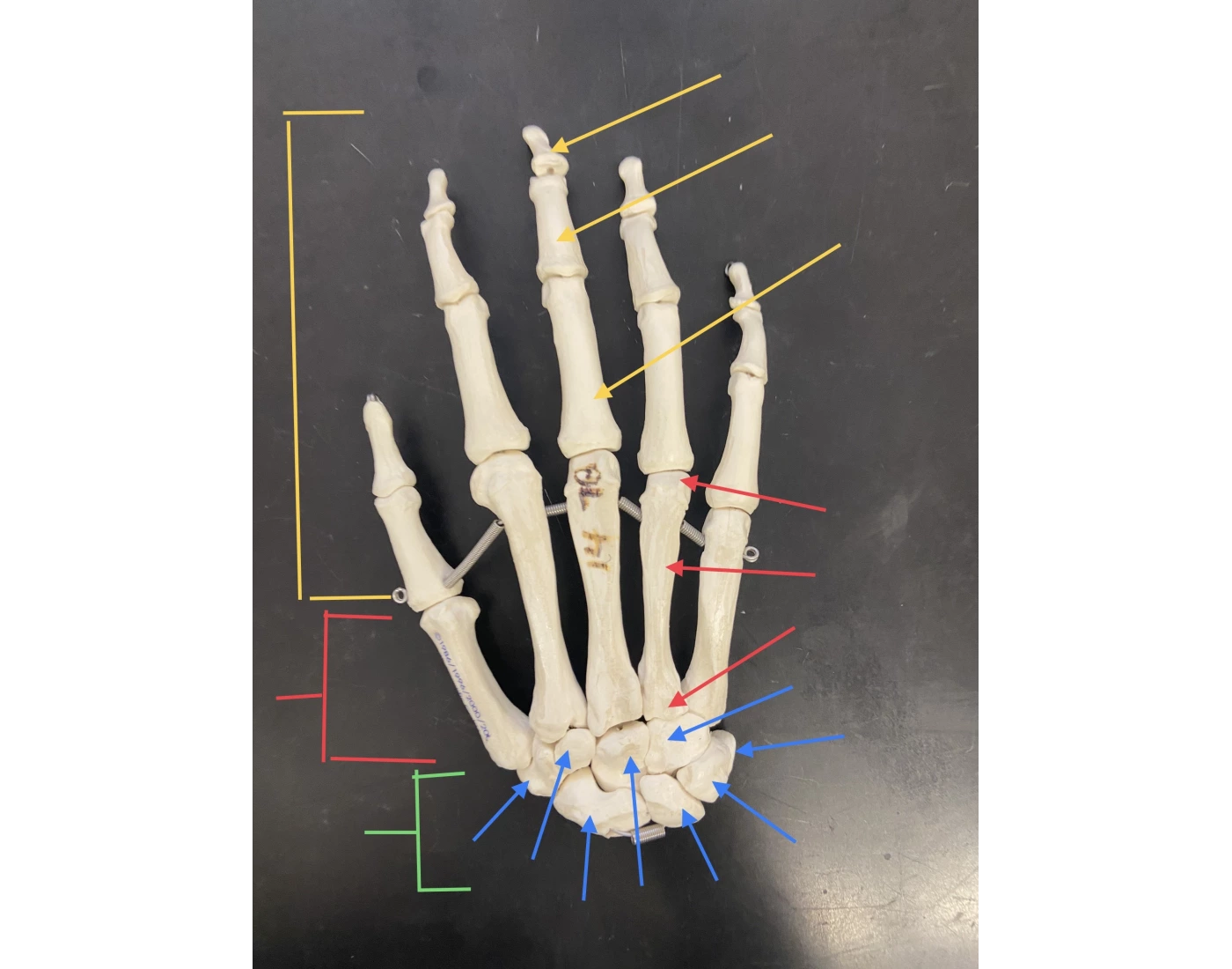 Right Hand Label Right Hand Posterior View bone labeling Quiz