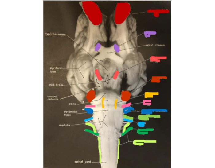 Cranial Nerves Quiz Cranial Nerves Quiz
