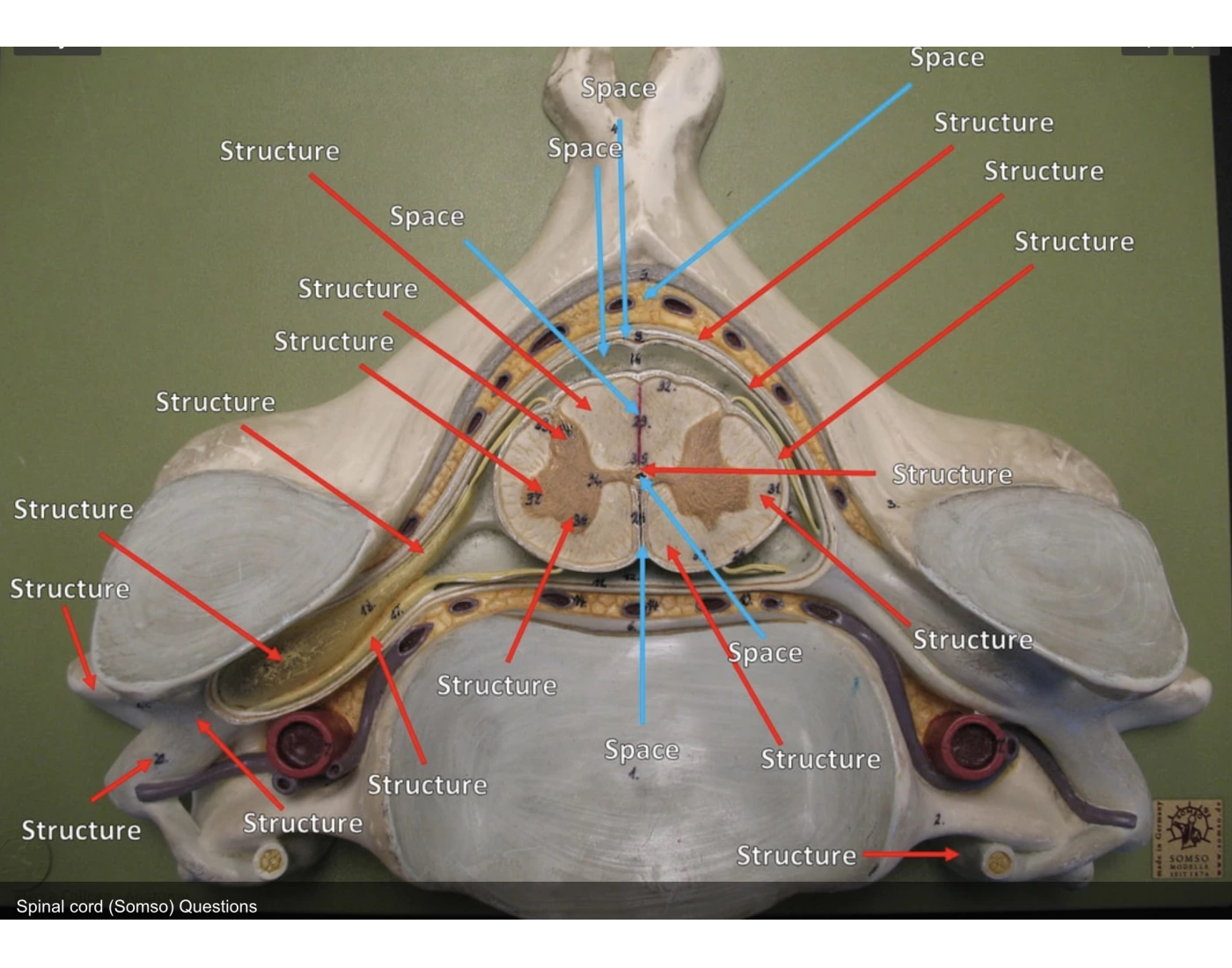 Cross Section Lab Model Spinal Cord Cross Section Model Quiz