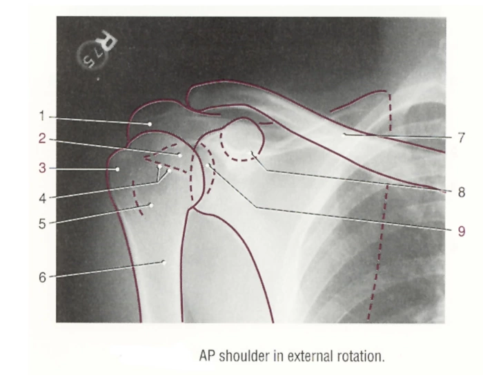 Radiographic anatomy- AP shoulder — Printable Worksheet