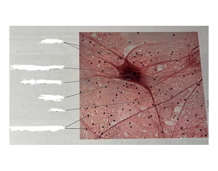 Neural Tissue Pattern Photomicrograph of neural tissue — Printable Worksheet
