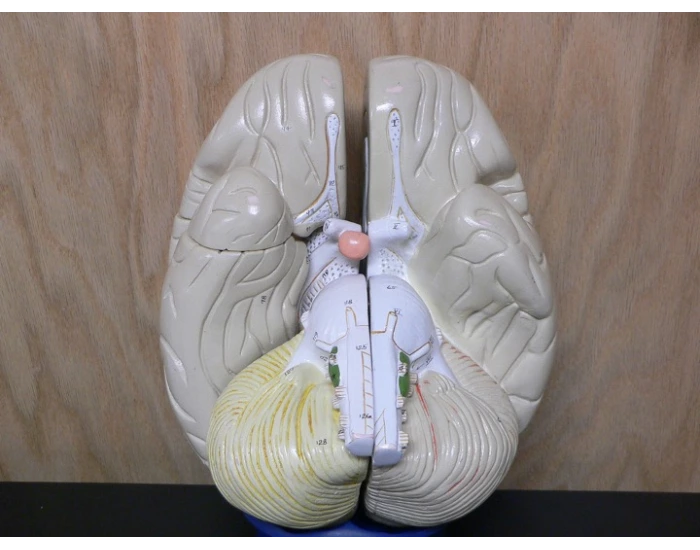 Upside down brain Quiz