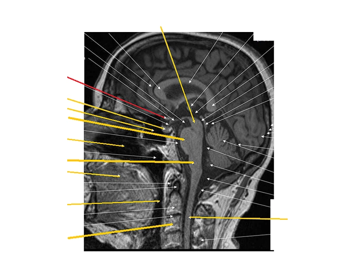 Sadgital Ridge Sagittal Head/Neck Labled Quiz