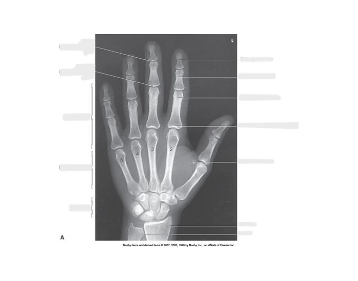 Labeling Radiographs Posterior Hand Radiograph Labeling Quiz