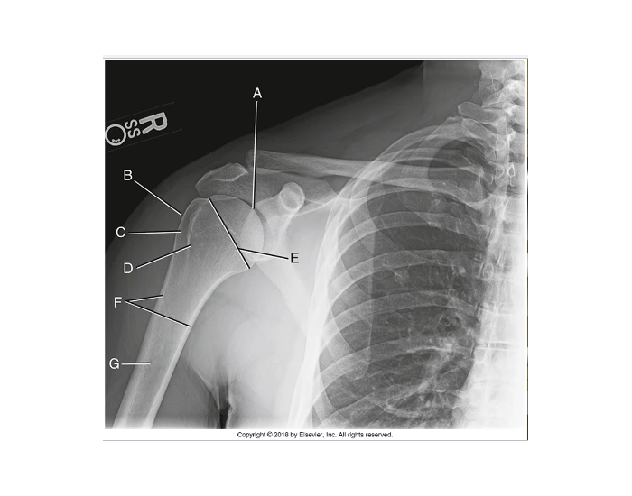 Shoulder Anatomy Quiz