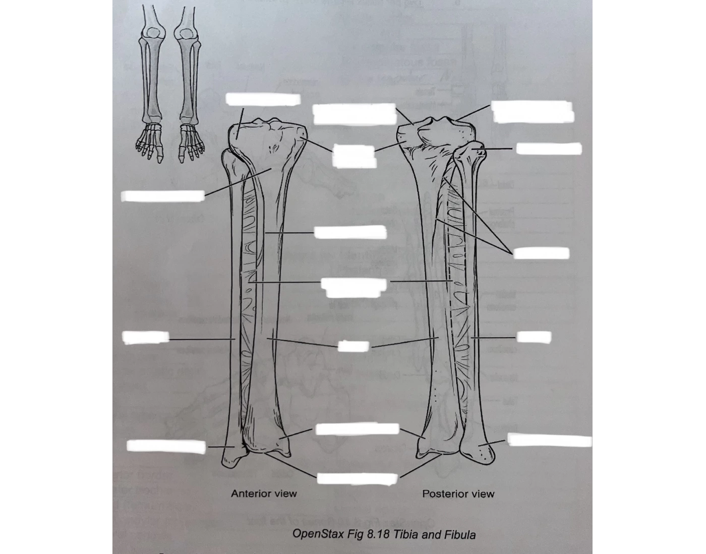Tibia Model Lab Tibia & Fibula Model Quiz