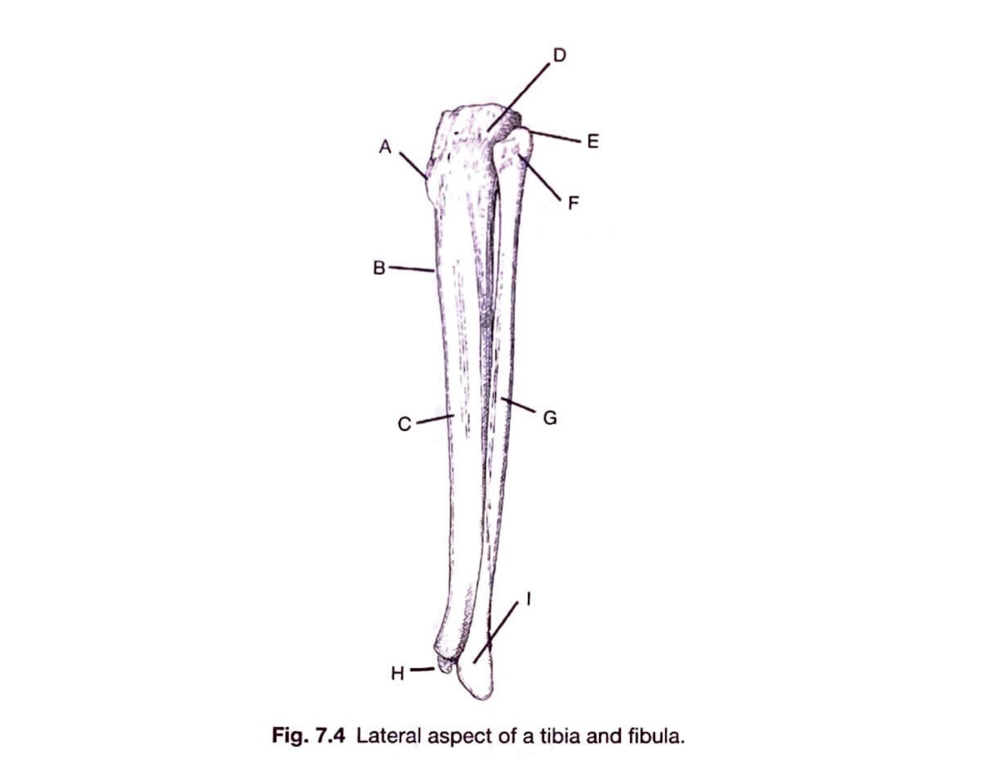 DMI 108 - Lower Extremities, Lateral Tib & Fib Quiz