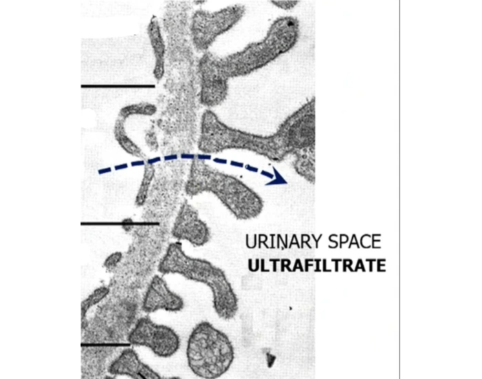 Filtration Labeling Renal filtration labeling Quiz