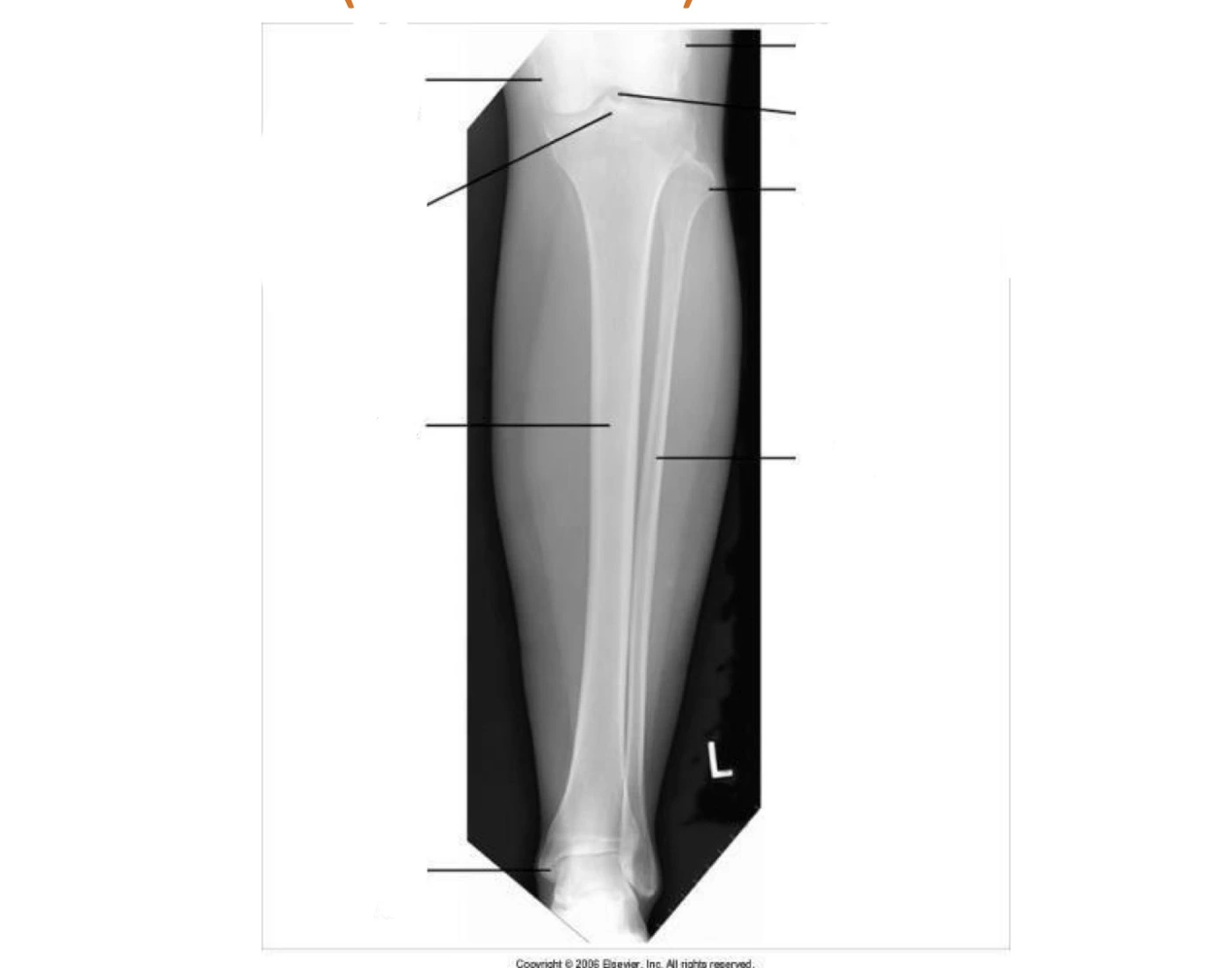 tibia and fibia continoued Quiz