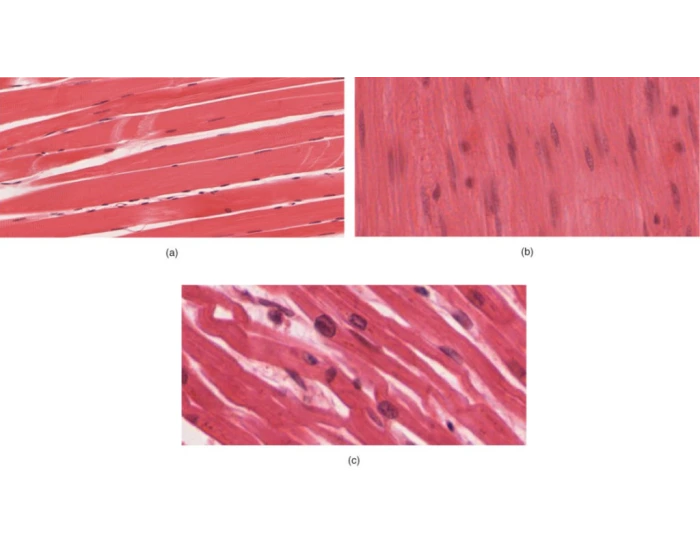 Muscle Types Quiz