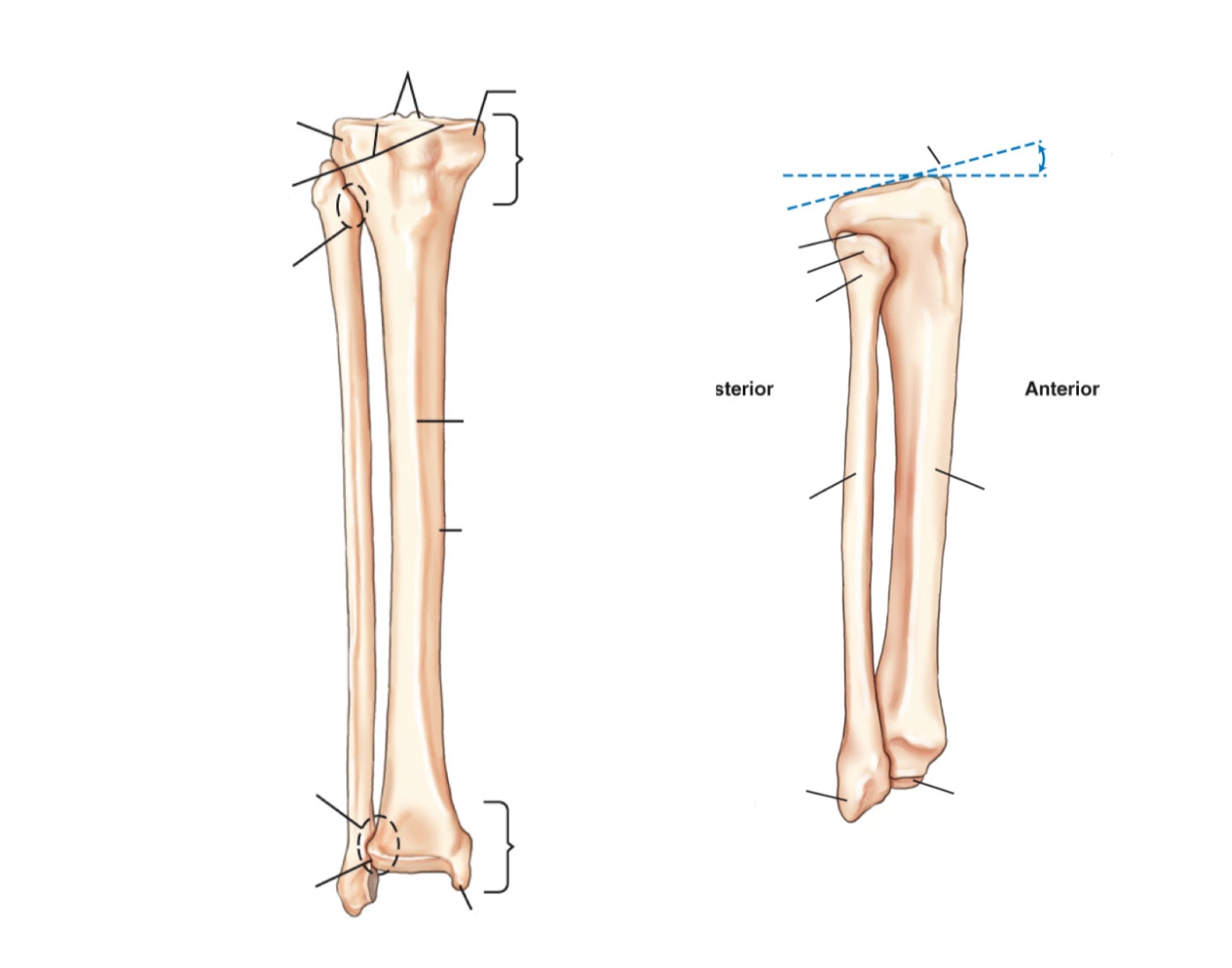 Tibia Starting View Anterior & Lateral Views Distal Tibia and Fibula r Quiz